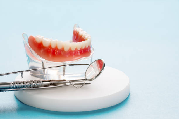 Dental Inlays and Onlays in Cathedral City, CA